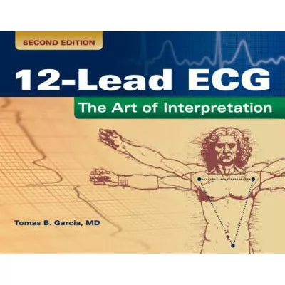 12-Lead ECG: The Art of Interpretation